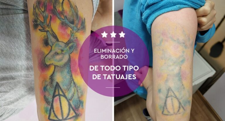 cuerpo limpio sin tatuajes en contraste