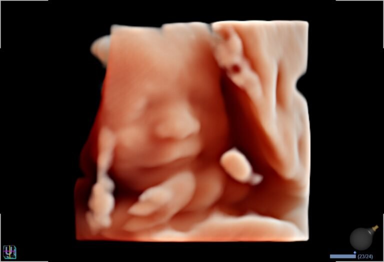 ecografia de embarazo con fondo emocional