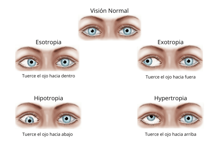 Qué sucedió con el ojo de Wanda Nara y cuáles son los detalles 26 ojo humano con enfoque en la mirada