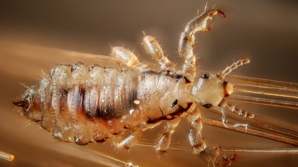 Qué Significa Soñar con Piojos en la Cabeza y Su Interpretación 4 Qué Significa Soñar con Piojos en la Cabeza y Su Interpretación