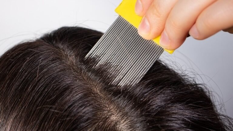 sueno con piojos y dinero